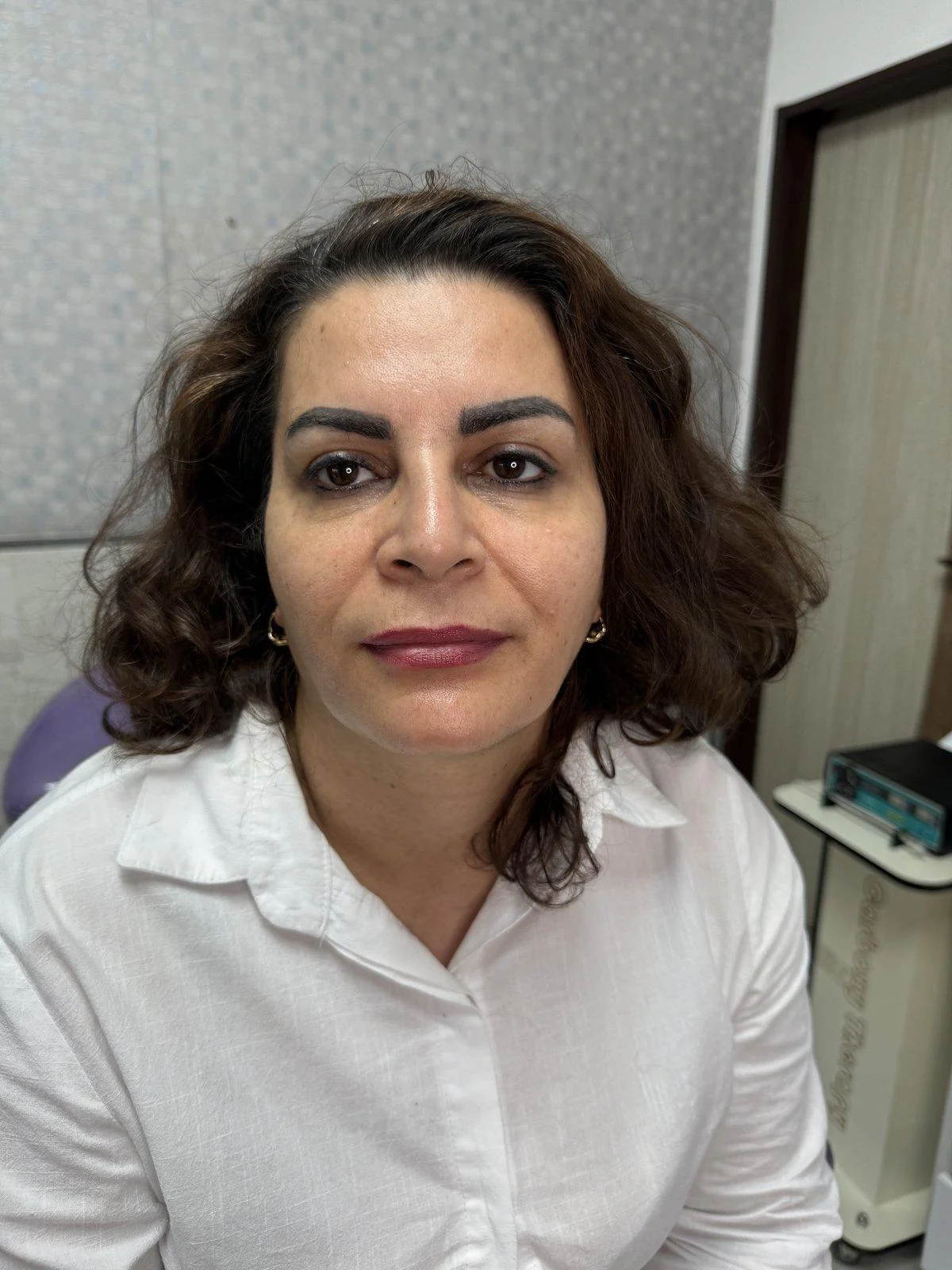 بوتاکس